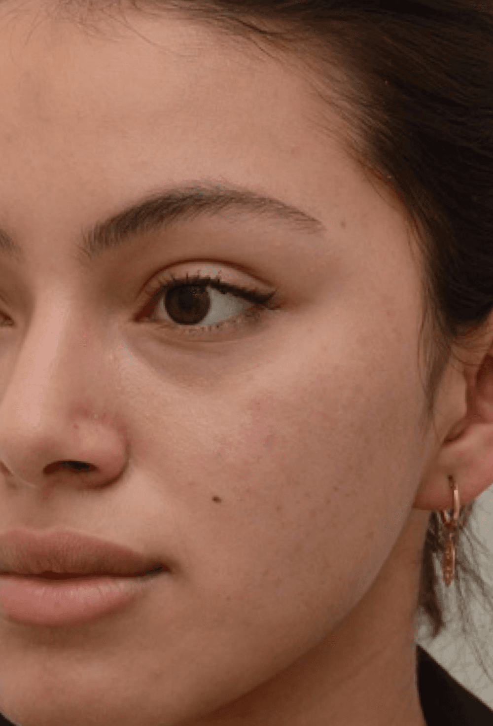 microneedling-after