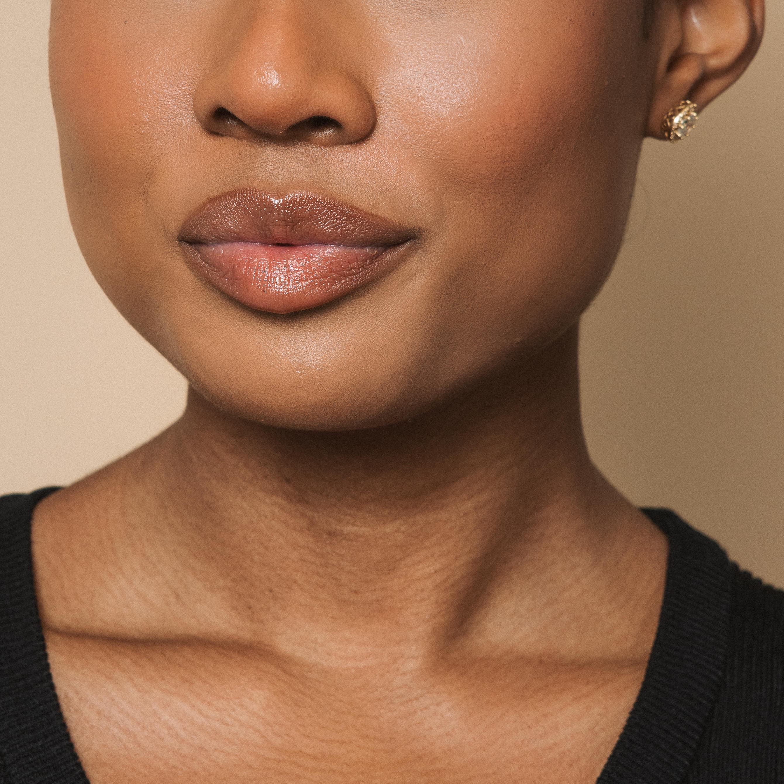 lip-fillers-main