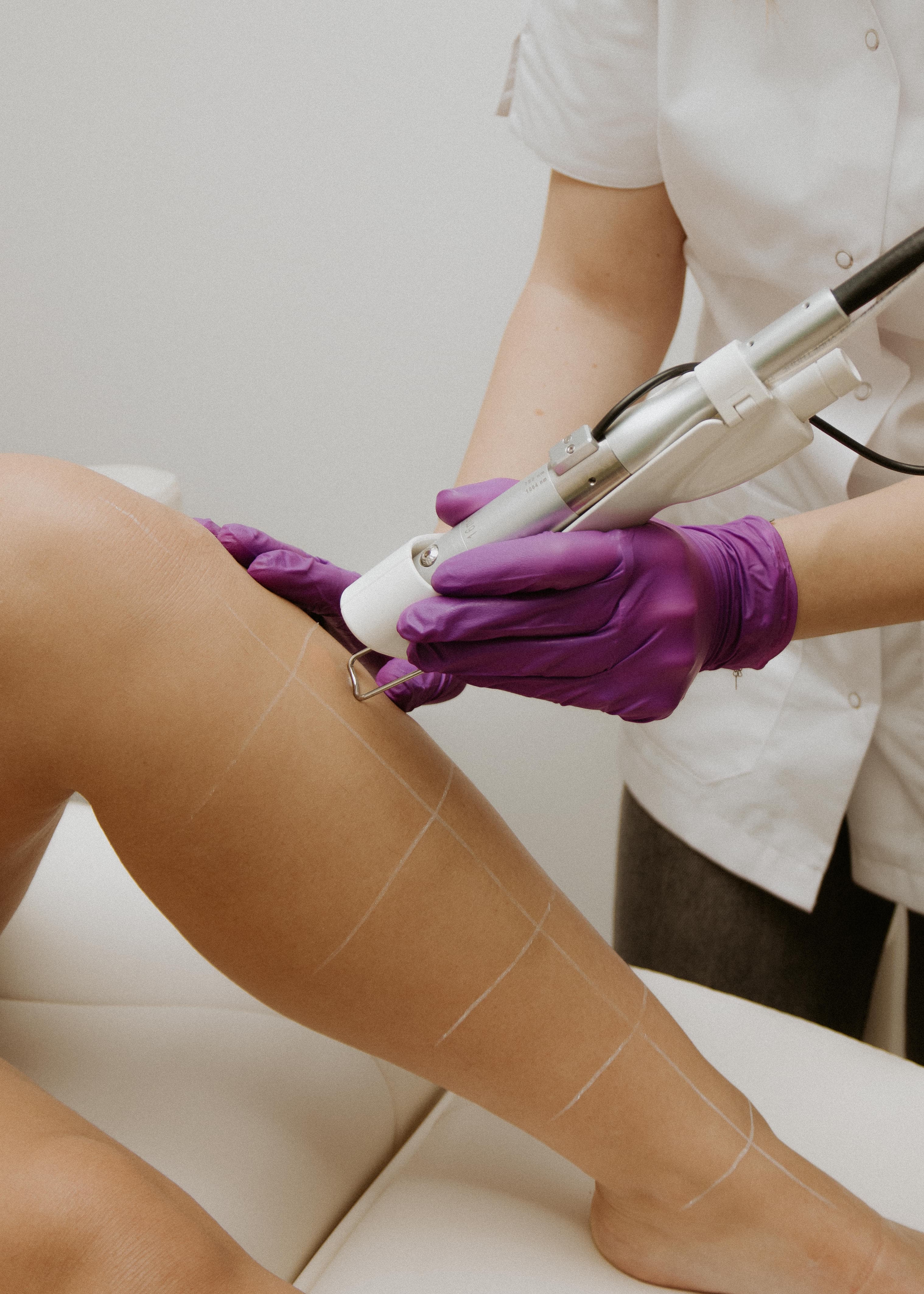 laser-hair-removal-leg