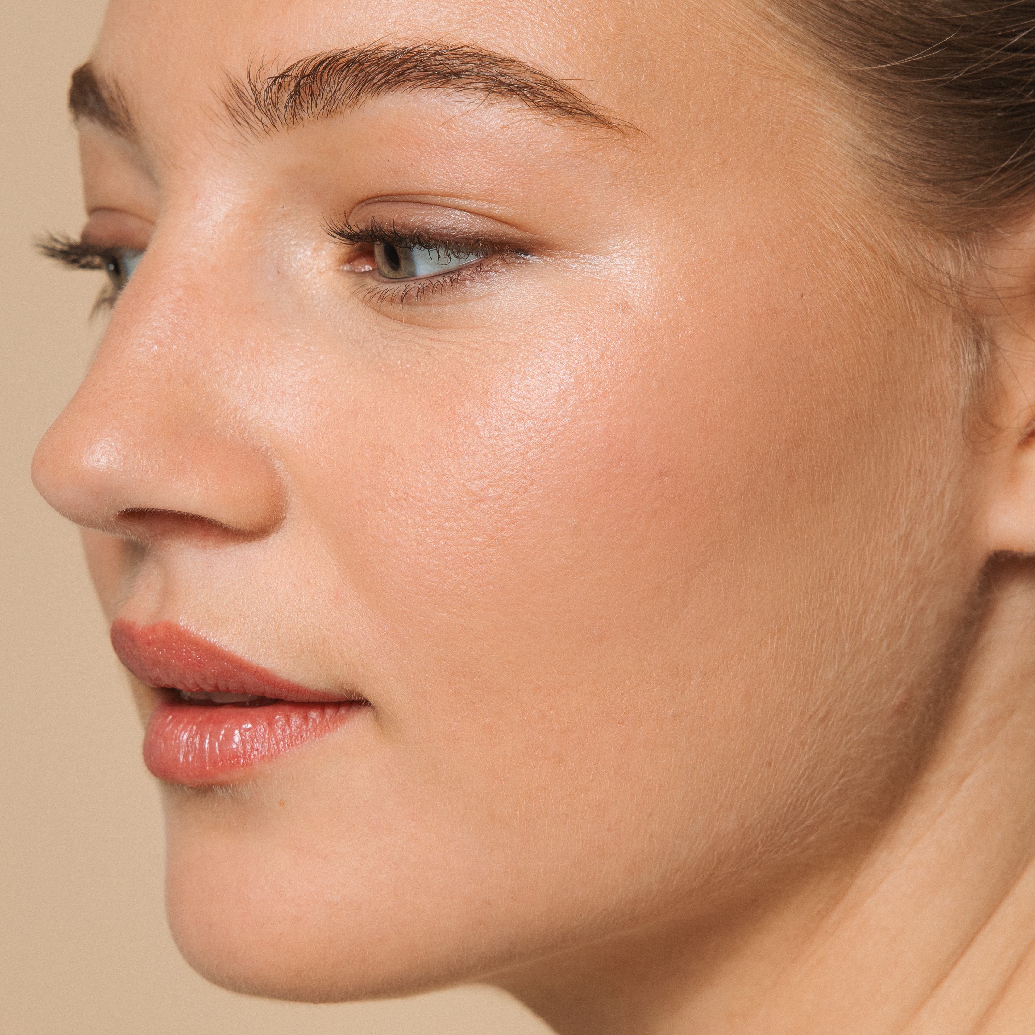 skin-couperose