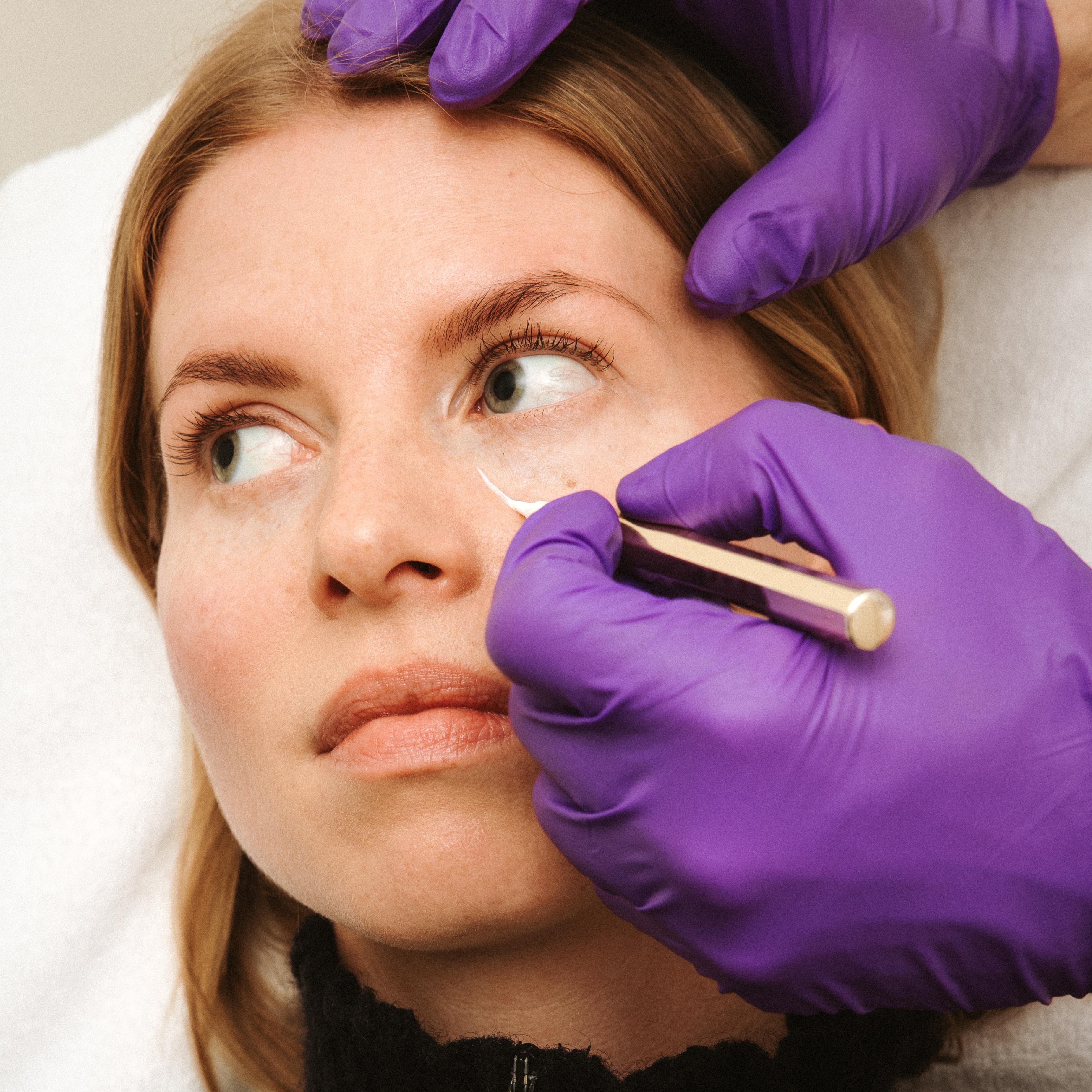 Close-up van een behandeling onder het oog bij Soap