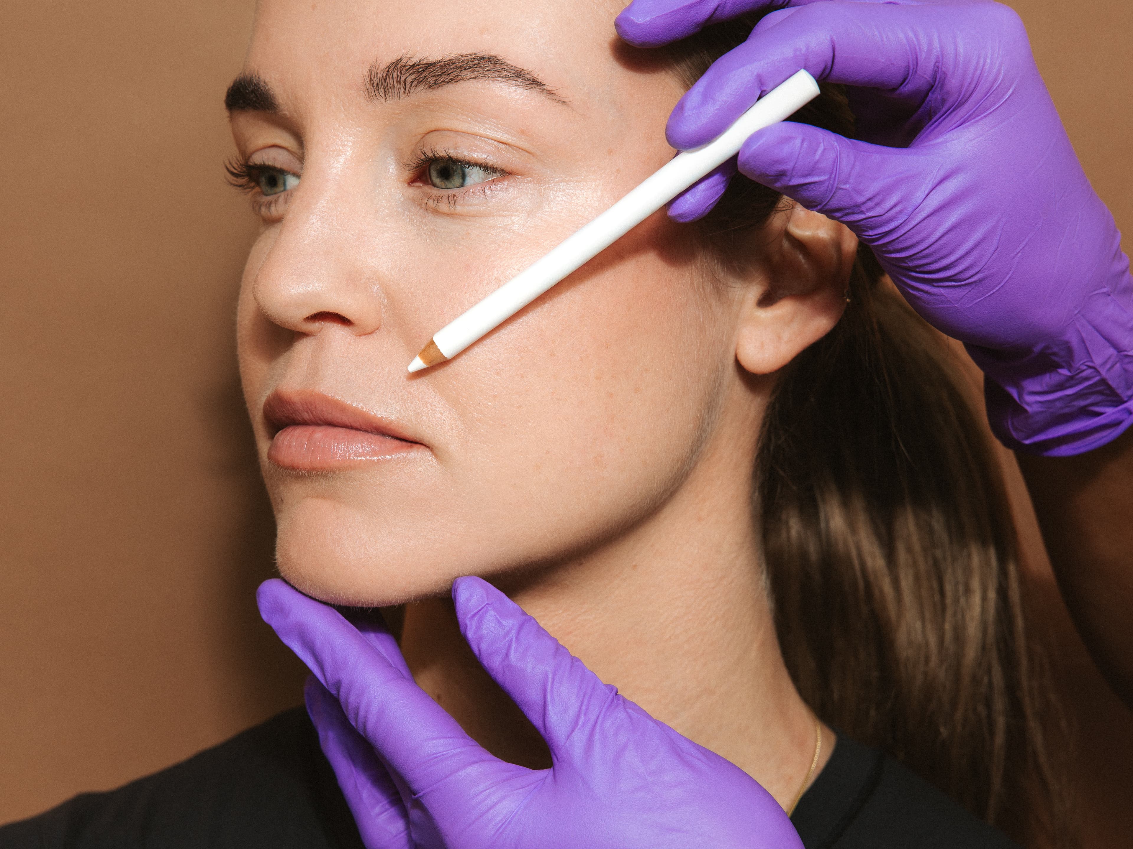 surgical-lip-lift