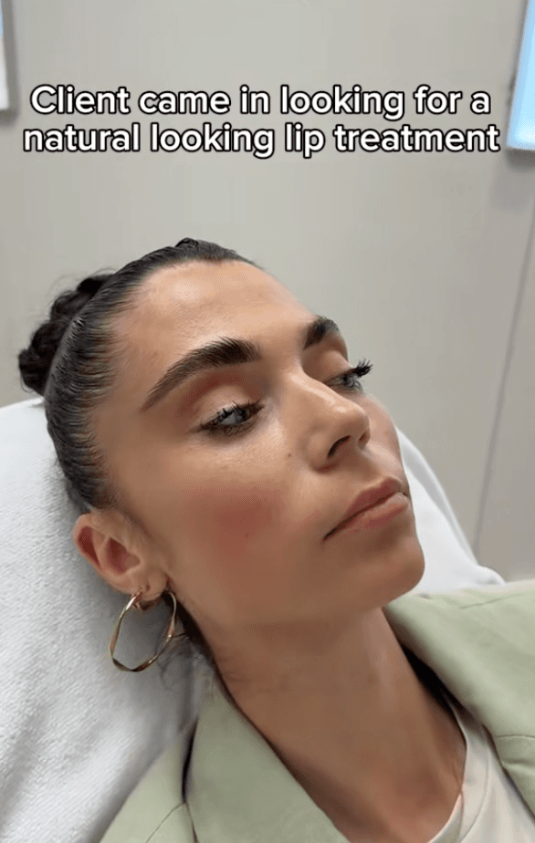 video-lip-treatment