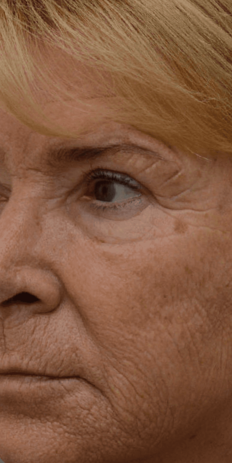 medical-peel-before