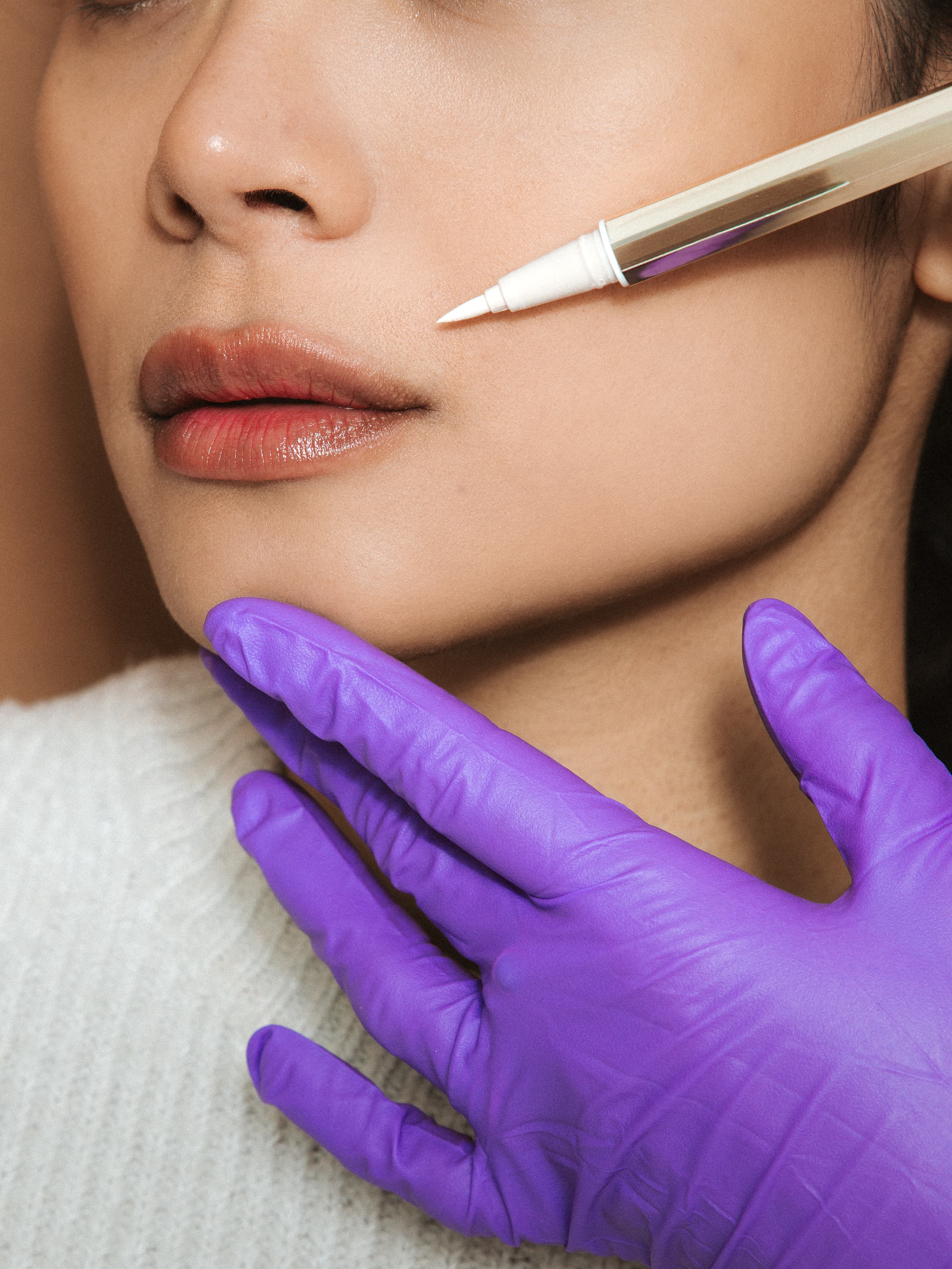 surg-lip