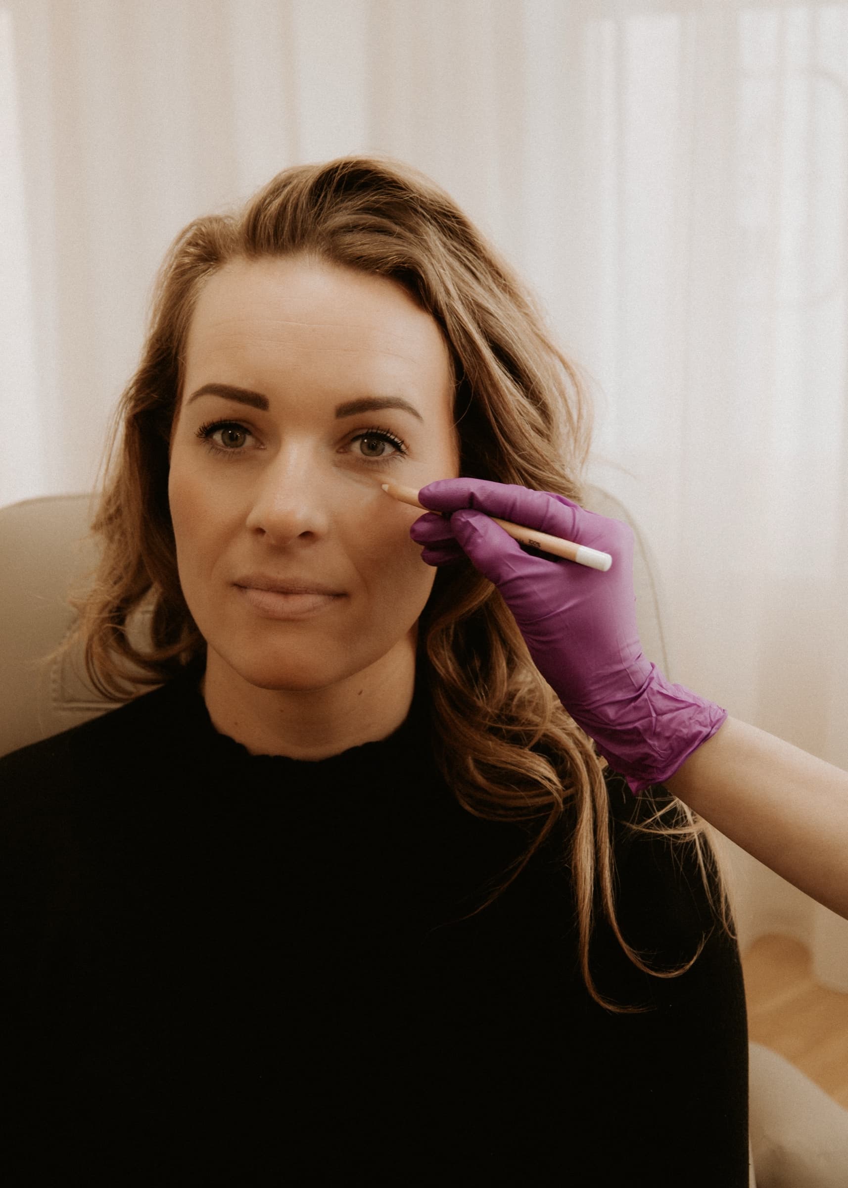Markering van het ooggebied voorafgaand aan een behandeling bij Soap